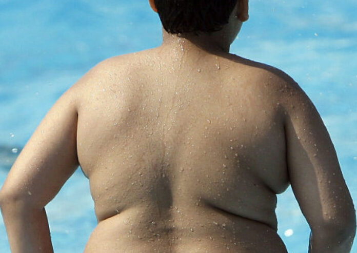 Overweight in Childen